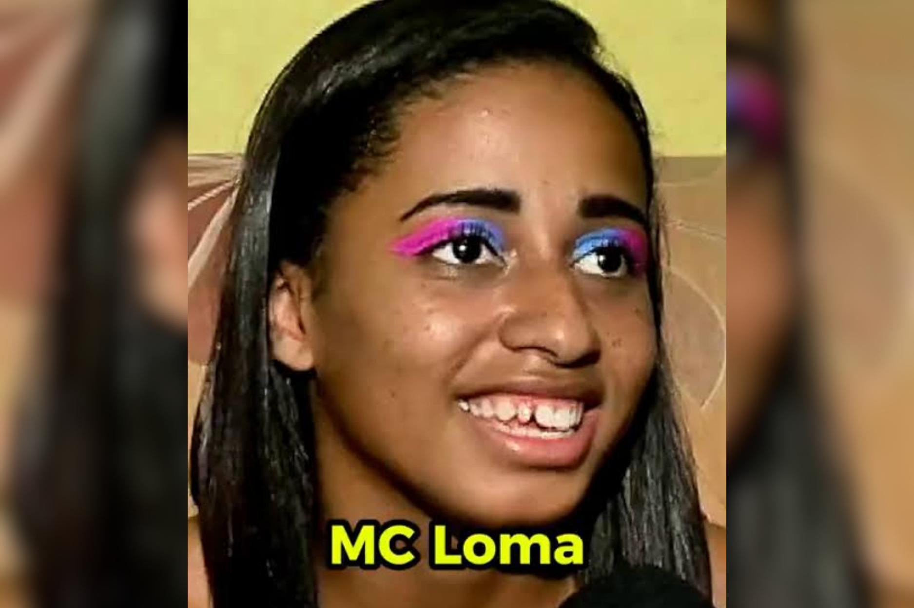 MC Lomma antes dos procedimentos estéticos