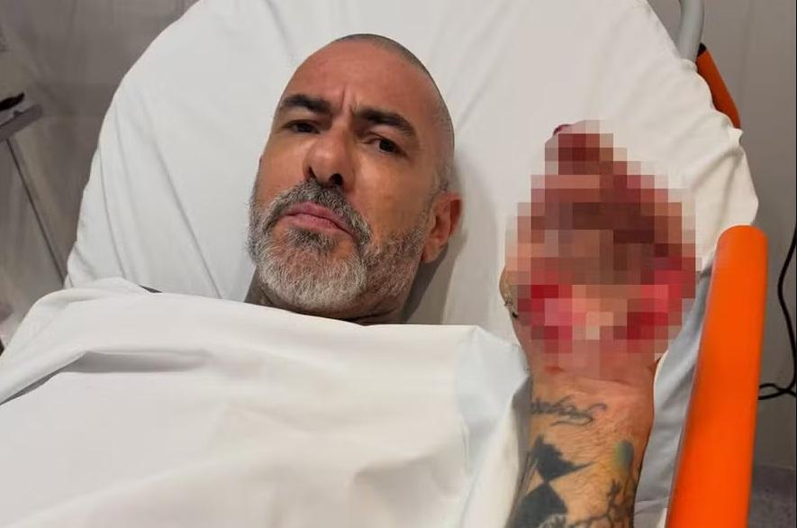Em rede social, Henrique Fogaça relata queda de motocicleta a 120 km/h e lesões graves
