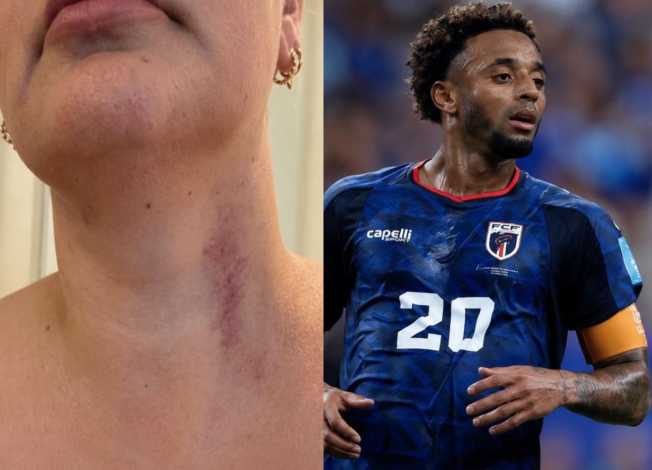 Ryan Mendes, capitão de Cabo Verde, é investigado por estuprar brasileira antes da Copa